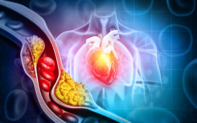Cholesterin senken: Tipps für eine herzgesunde Lebensweise